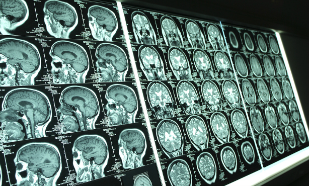 Dutch computer programme predicts future illnesses