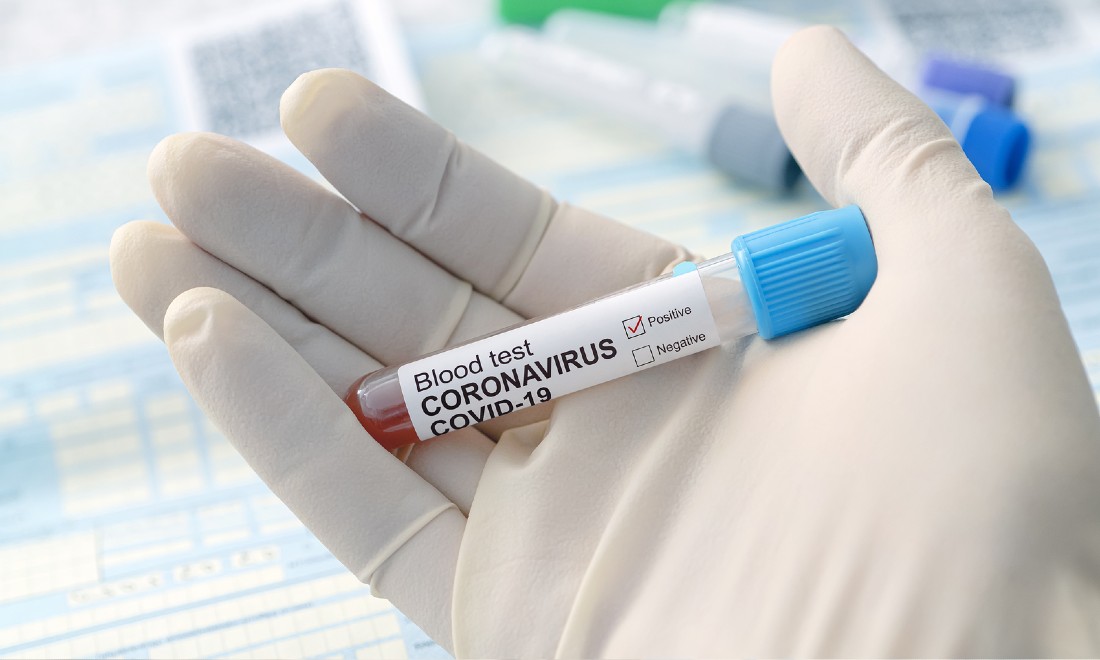 Coronavirus update (March 25): 6412 confirmed cases