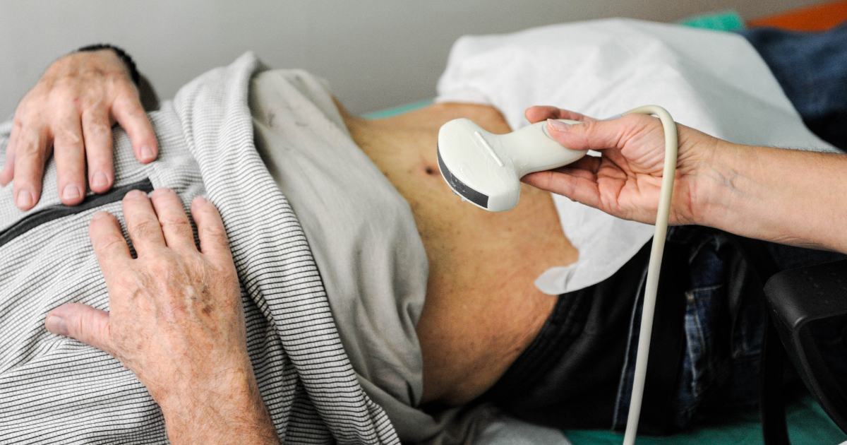Free liver test in Amsterdam sees people queuing up for hours